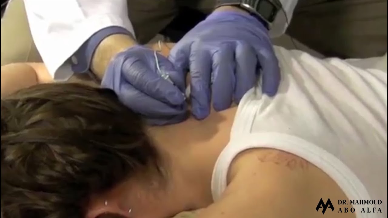 Electromyography (EMG) Chapter (Basics & Applied) - Clinical EMG Techniques Upper & Lower Extremity