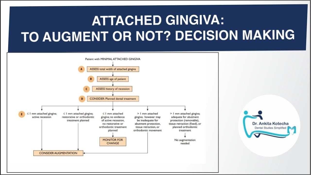 DECISION MAKING: ATTACHED GINGIVA: TO AUGMENT OR NOT?/ DR. ANKITA KOTECHA/ DENTAL STUDIES SIMPLIFIED