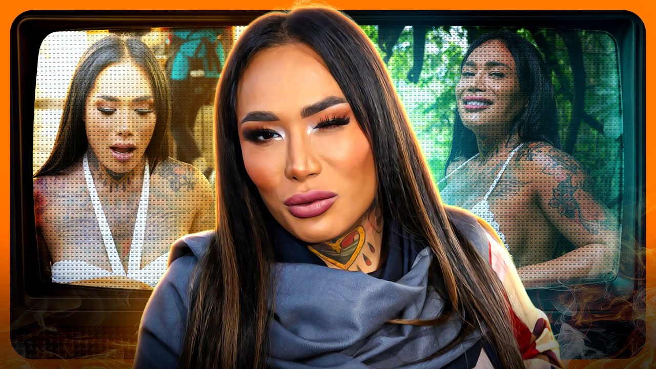 KARINA TORRES ESTUVO AL BORDE DE LA MUERTE TRAS SUFRIR COMPLICACIONES POR LOS BIOPOLÍMEROS