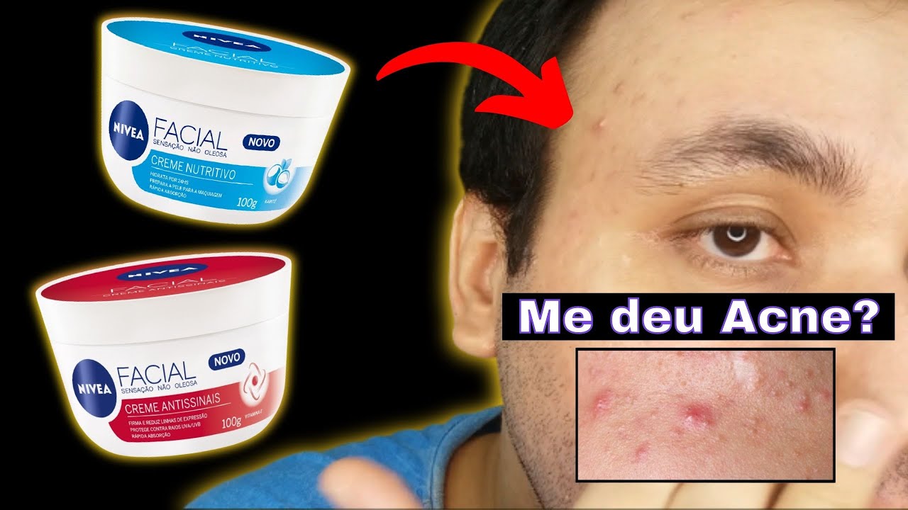 Creme Nivea ANTISSINAIS E NUTRITIVO | Para PELE OLEOSA? | ME DEU ACNE? | Hidratante para o Rosto.