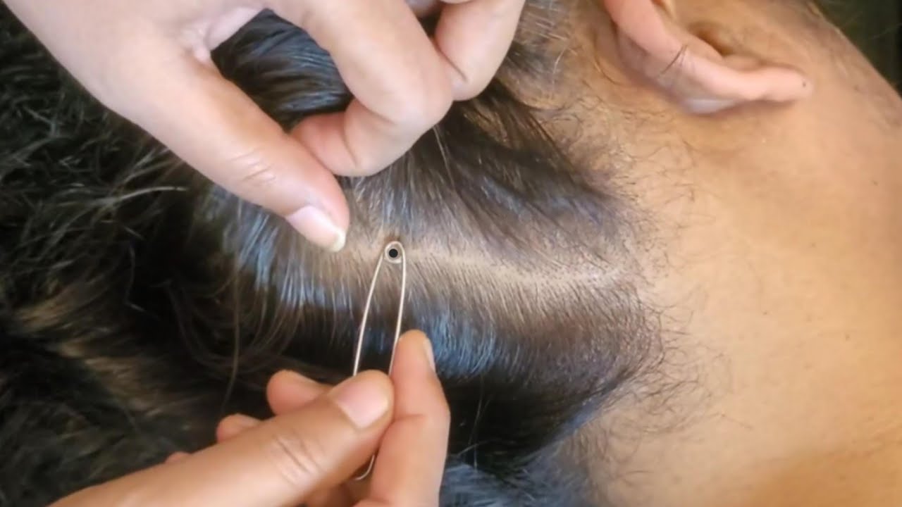Scalp Check: The Most Satisfying Deep Clean!