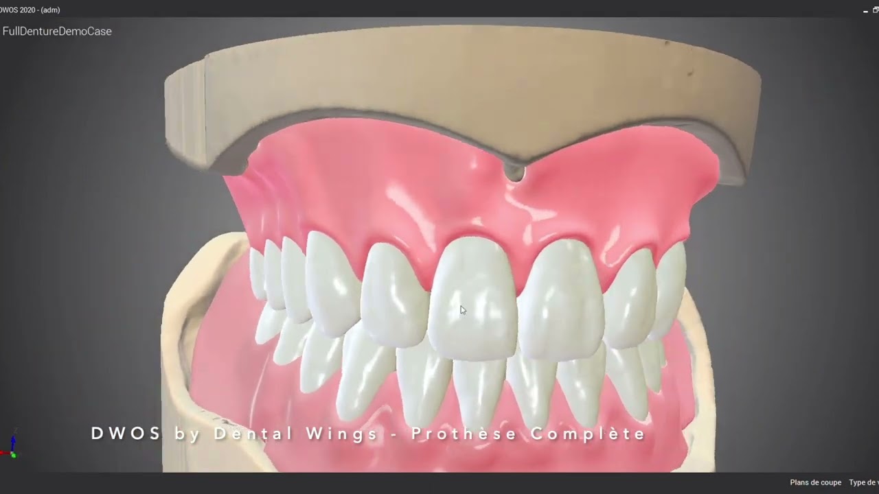 DWOS by Dental Wings