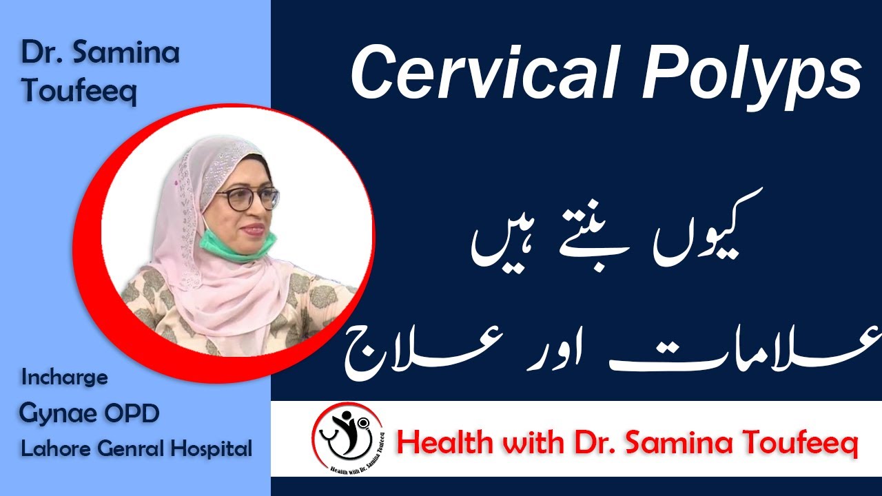 Cervical Polyps Ki  Symptoms aor Elaj In Urdu Hindi By Dr Samina Toufeeq