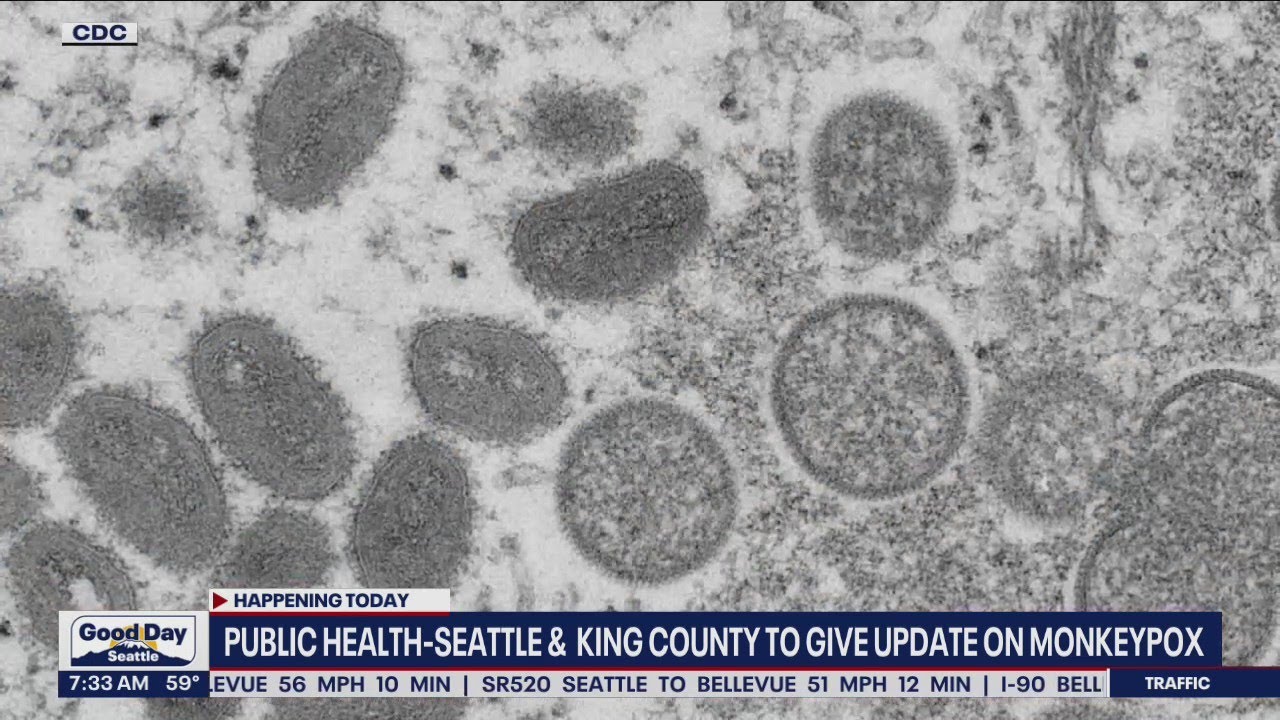 Public Health-Seattle, King County to give update on monkeypox | FOX 13 Seattle