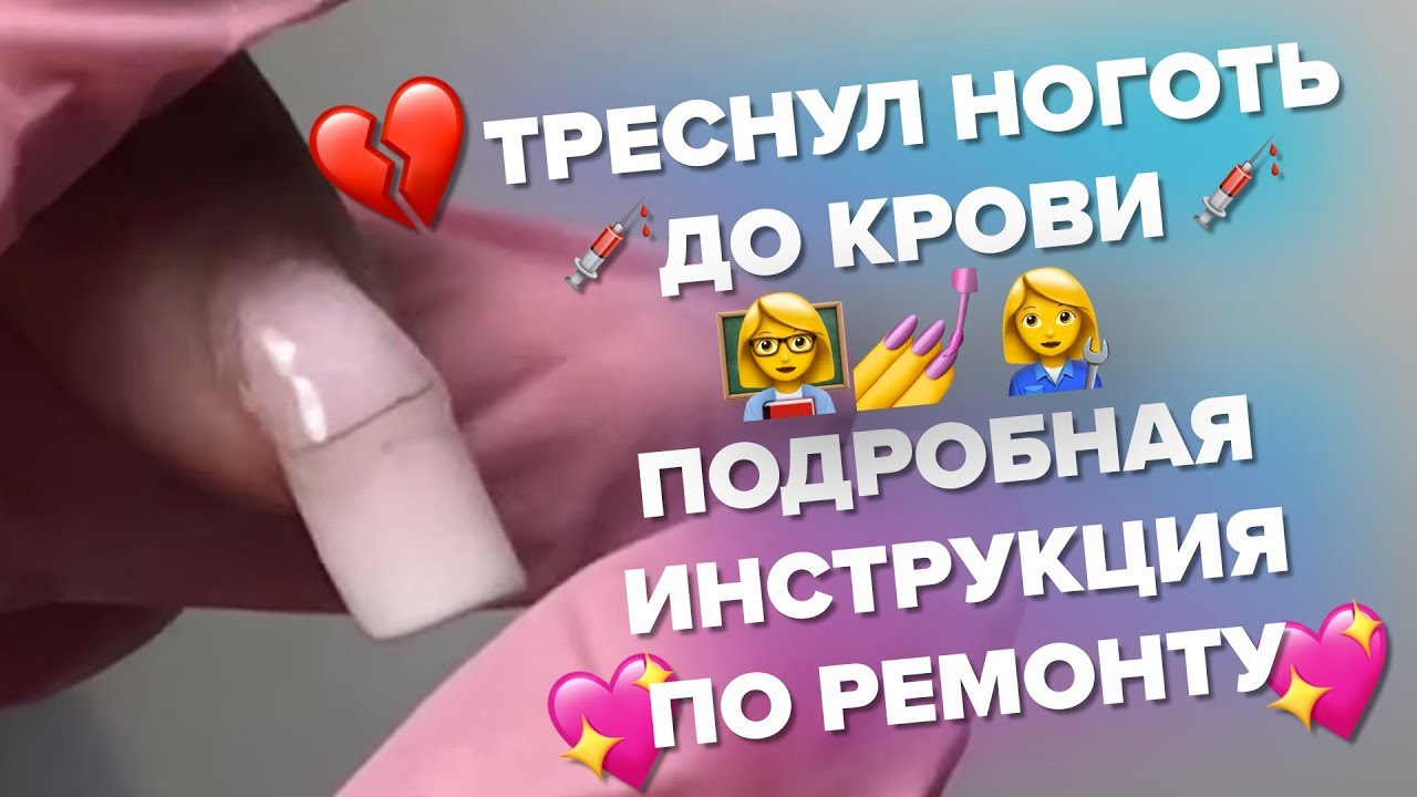 Как отремонтировать треснувший ноготь.