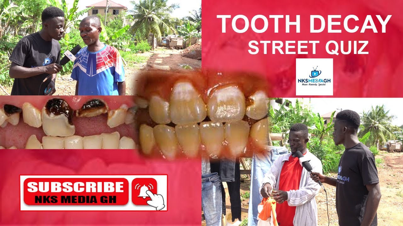 Very funny as some Ghanaians gave us  the English name for a decayed teeth.