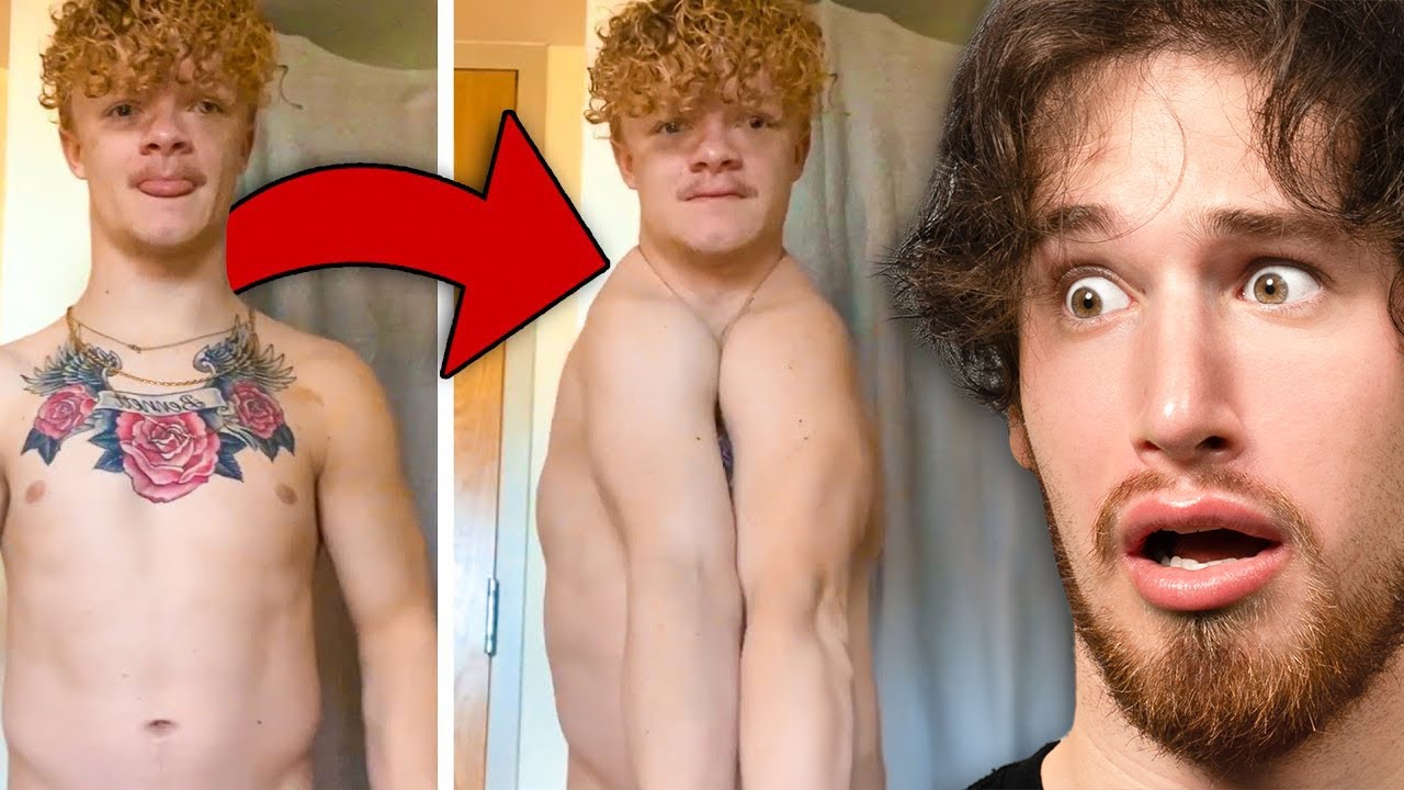 Man Born WITHOUT A Collarbone