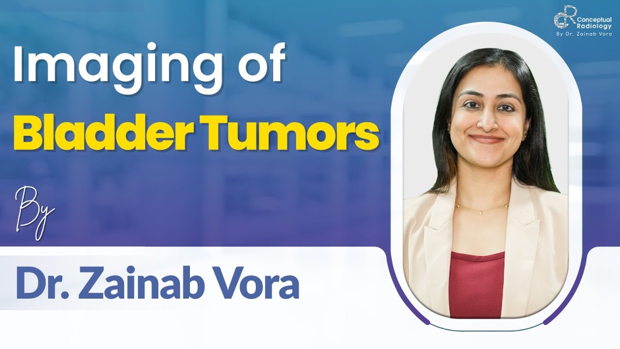 Bladder Tumor Imaging Simplified | VIRADS, Staging & Key Concepts by Dr. Zainab Vora