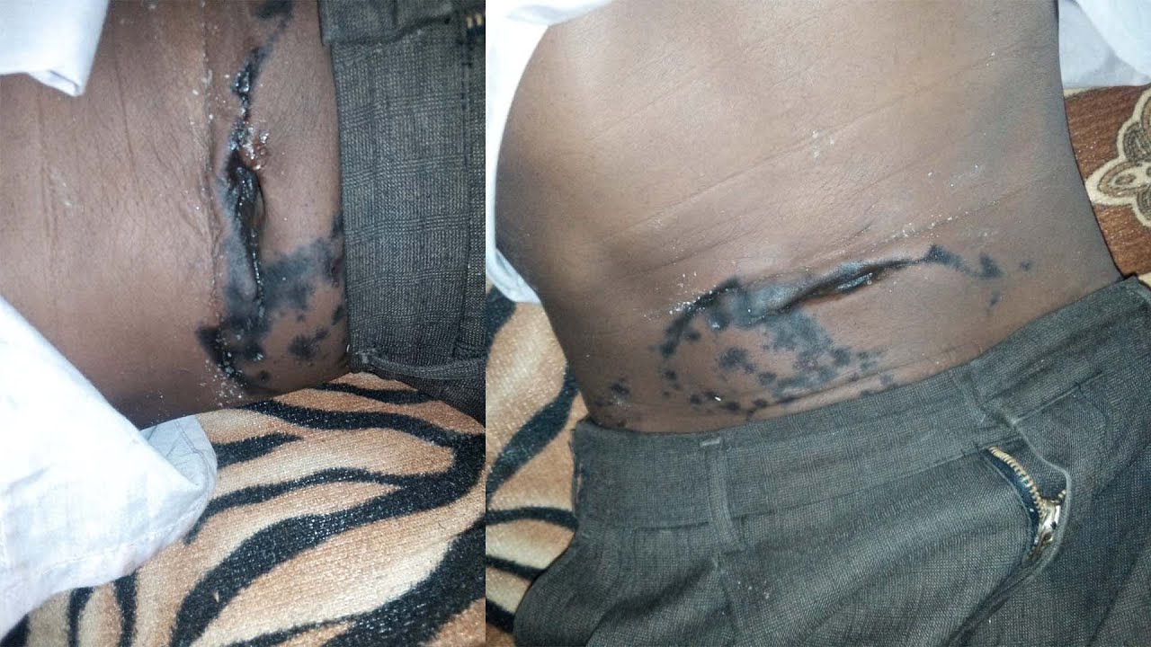 Oborogi? Omosacha gosaragwa nabanto batamanyiri botuko ekero atindire
