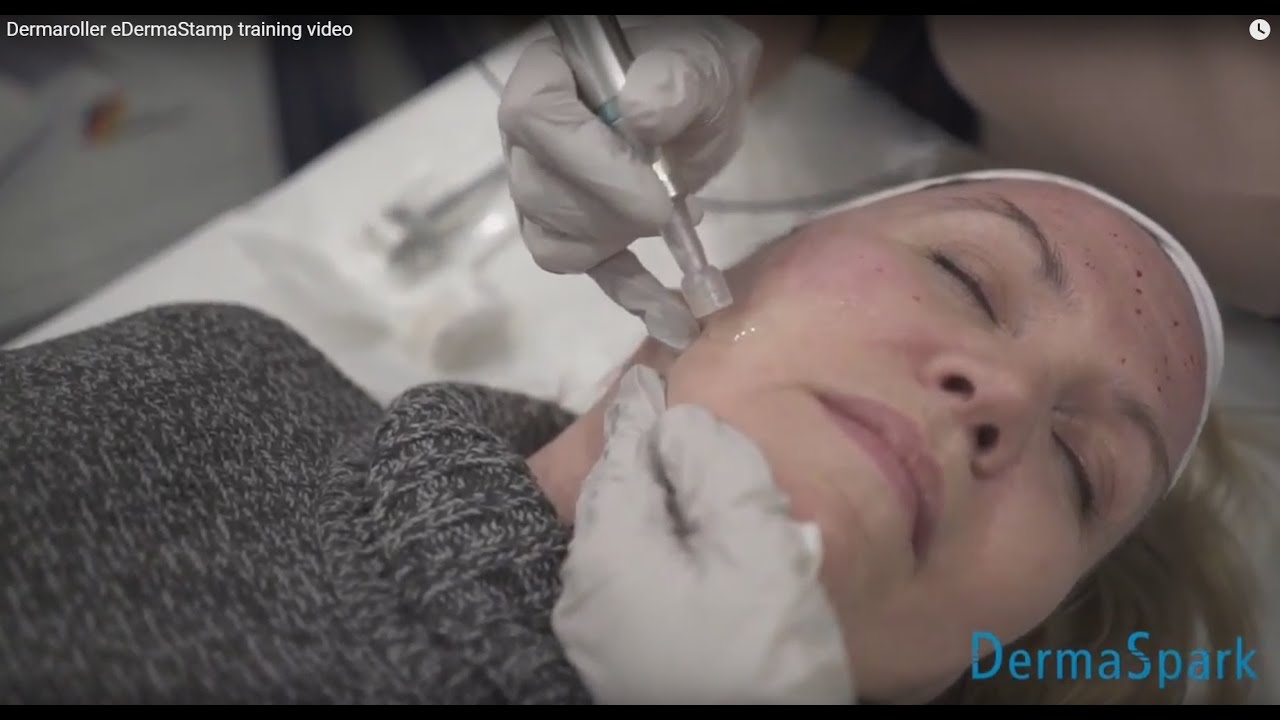 Dermaroller - eDermastamp training video