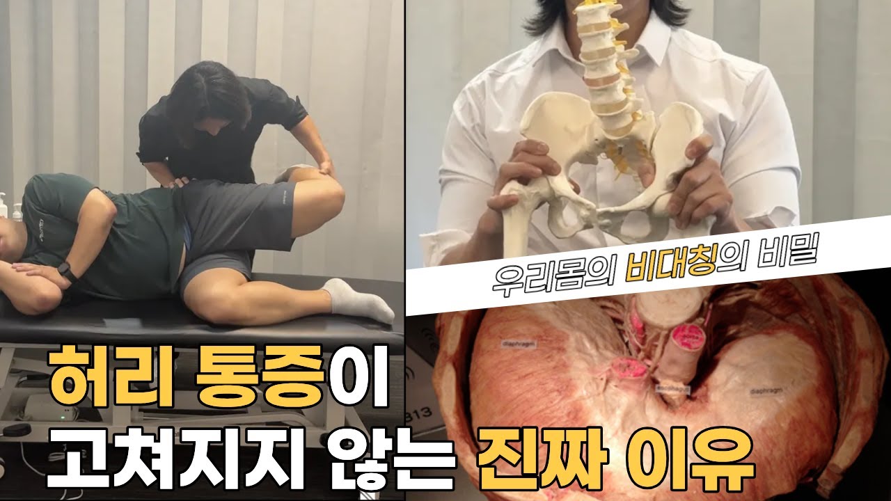 허리통증을 고쳐지지 않는 진짜이유 (대부분이 몰랐던 우리몸의 비대칭의 비밀)