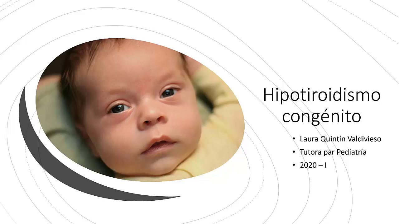 Hipotiroidismo Congénito