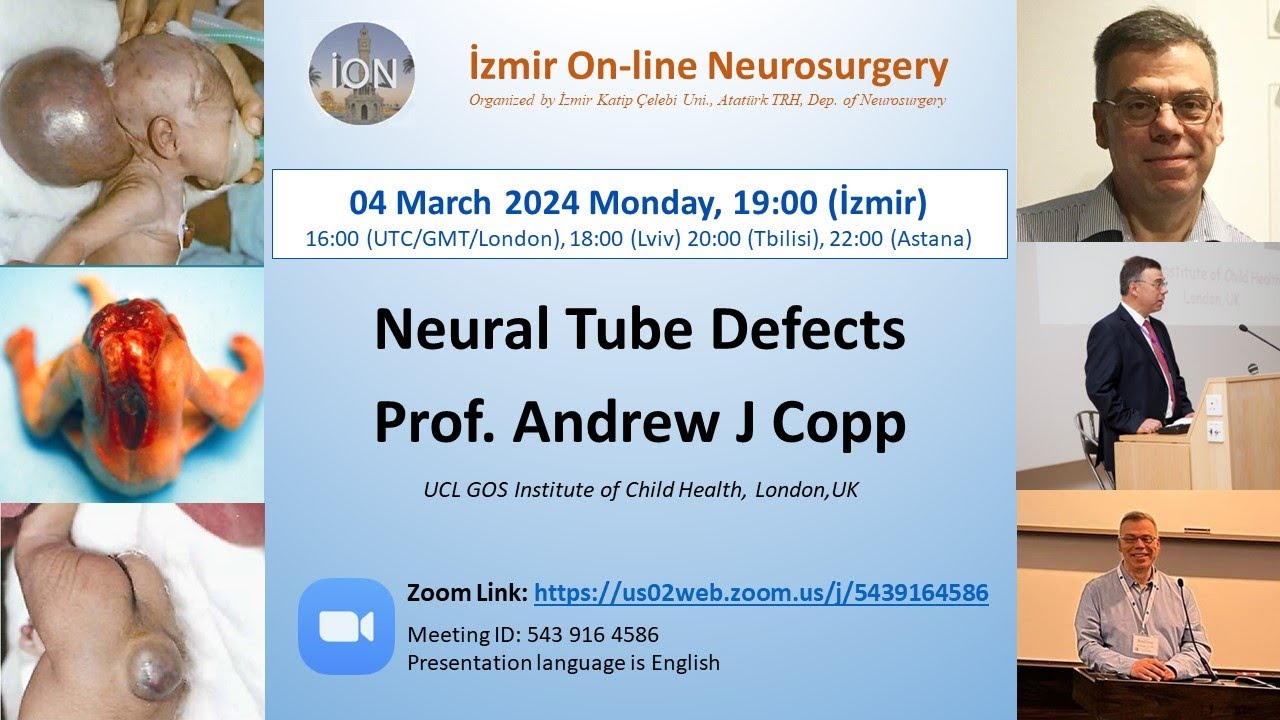 İON 425. Lecture, Copp: Neural Tube Defects 04.03.2024