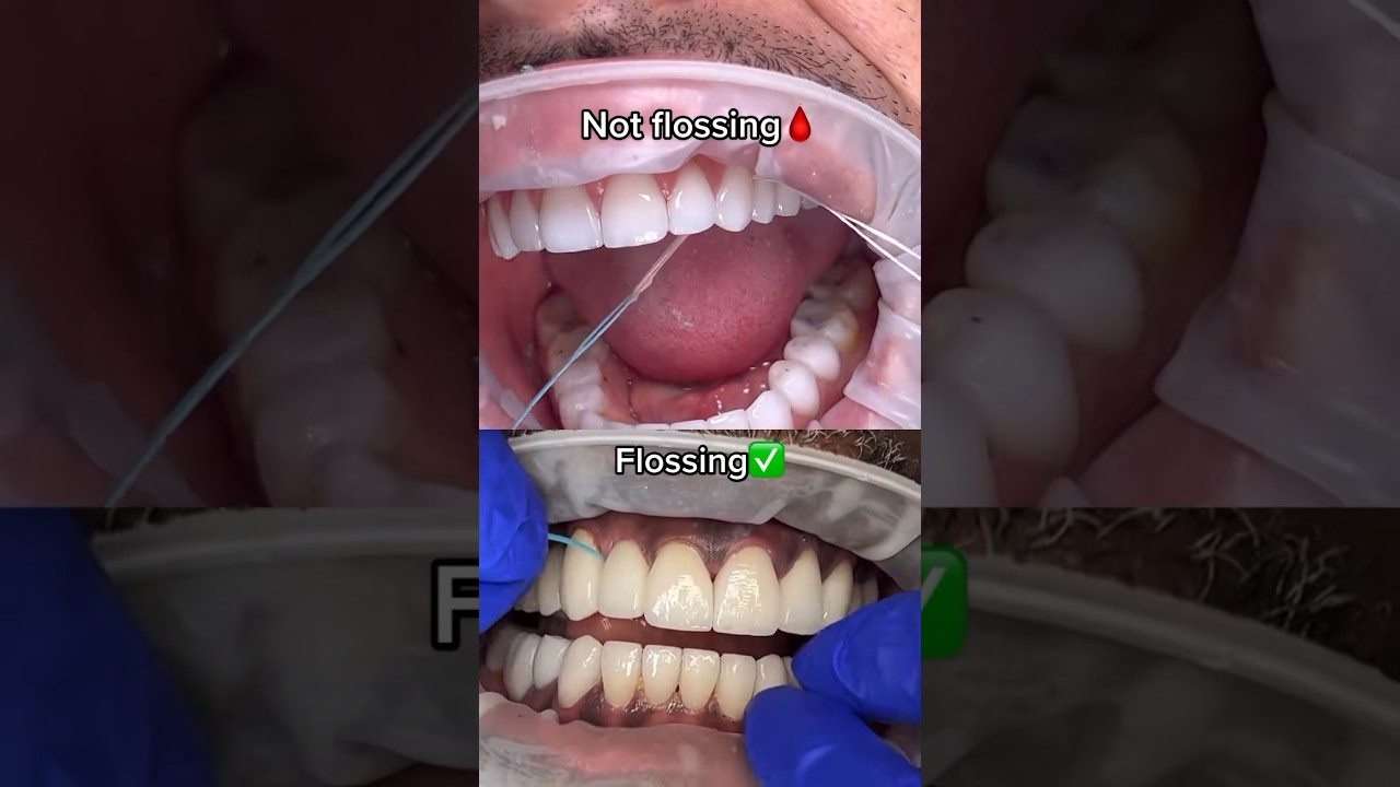 Absolutnie NAJLEPSZY spos&oacute;b na nitkowanie zęb&oacute;w! 🦷🪥