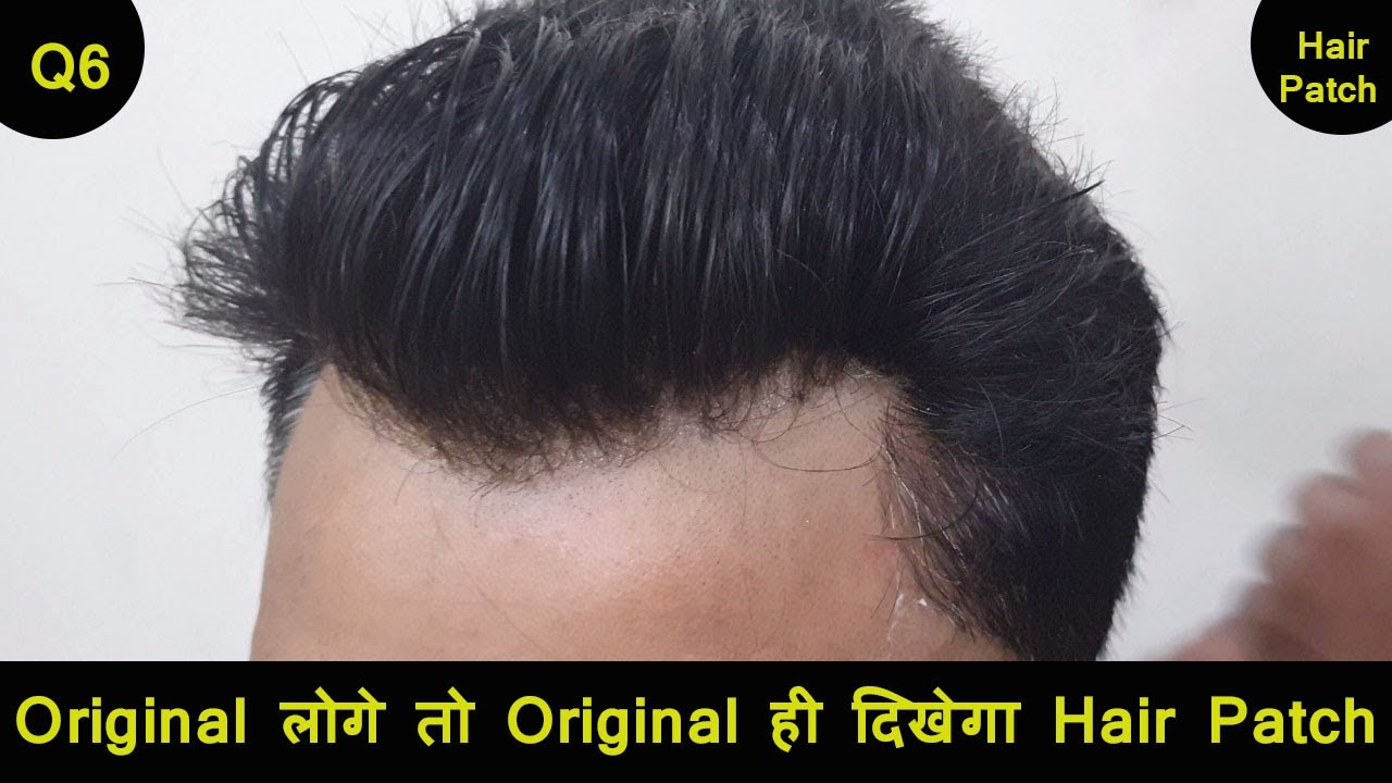Q6 Frontline Full Lace Vs Frontlace Hair Patches for Men | Amazing Hair Transformation | Hair Wigs