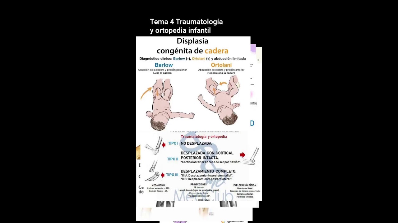 Tema 4 Traumatología y ortopedia infantil
