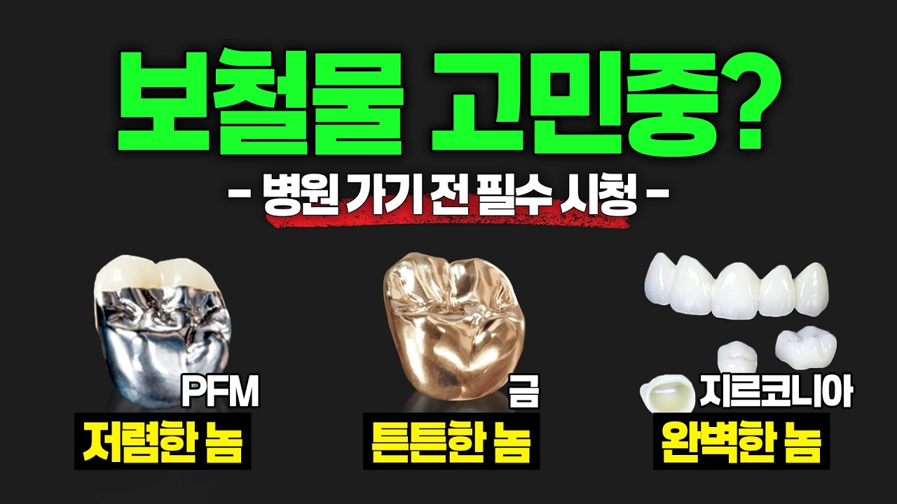 임플란트 보철물 고민끝! '이것' 모르면 2배 비싸게 할 수도...! 보철물 종류와 특징(지르코니아, 금니, PFM 장단점 총정리)