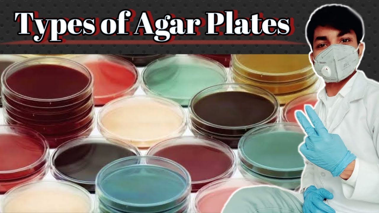 Types of Agar Plate | Culture Plates | Types of agar plate and their uses | Agar Plates | Agar Media