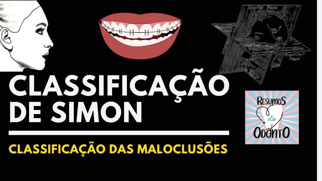 CLASSIFICAÇÃO DE SIMON| DIAGNÓSTICO DAS MÁS OCLUSÕES DENTÁRIAS