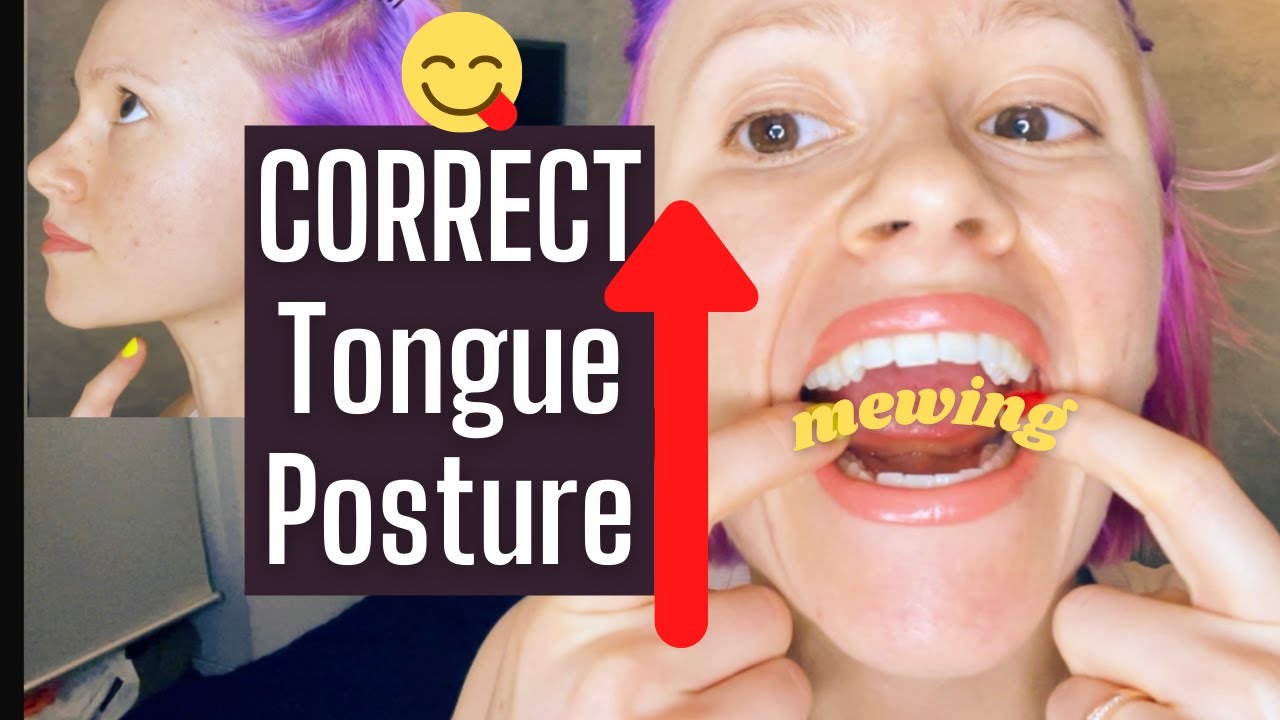 Mewing - How to Achieve Correct Tongue Posture: Placement, Back 1/3, Push on Palate