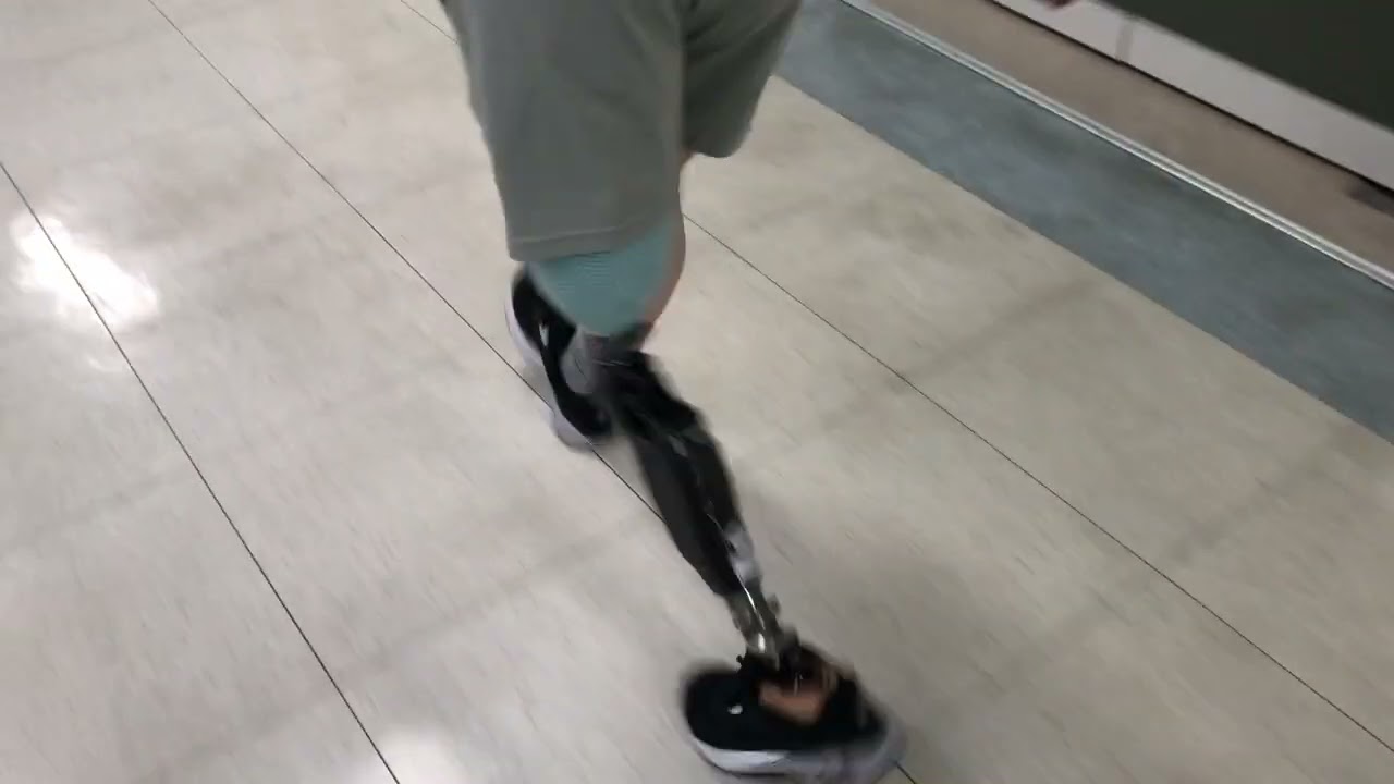 Trying on prosthetic knee joint in Korea