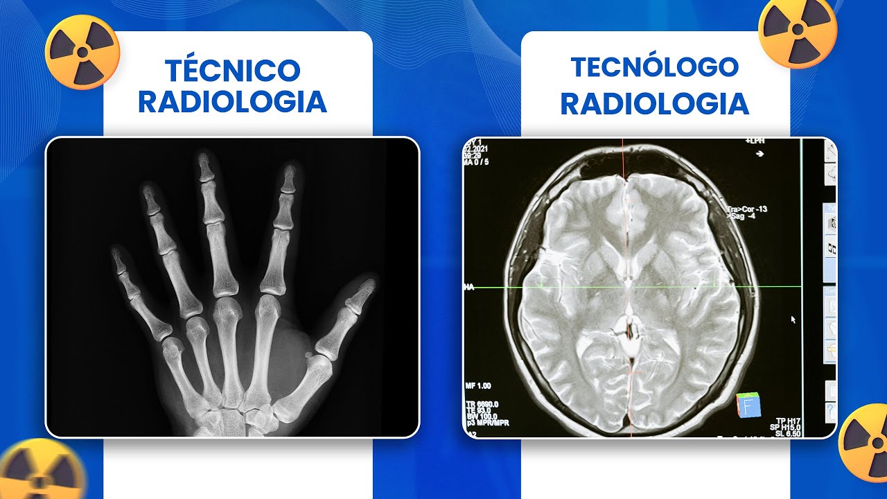 TÉCNICO OU TECNÓLOGO EM RADIOLOGIA? DESCUBRA A DIFERENÇA! ⚡