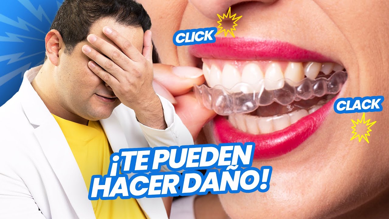 LOS ALINEADORES DENTALES INVISIBLES NO SON PARA TODOS &iquest;PUEDES USARLOS?