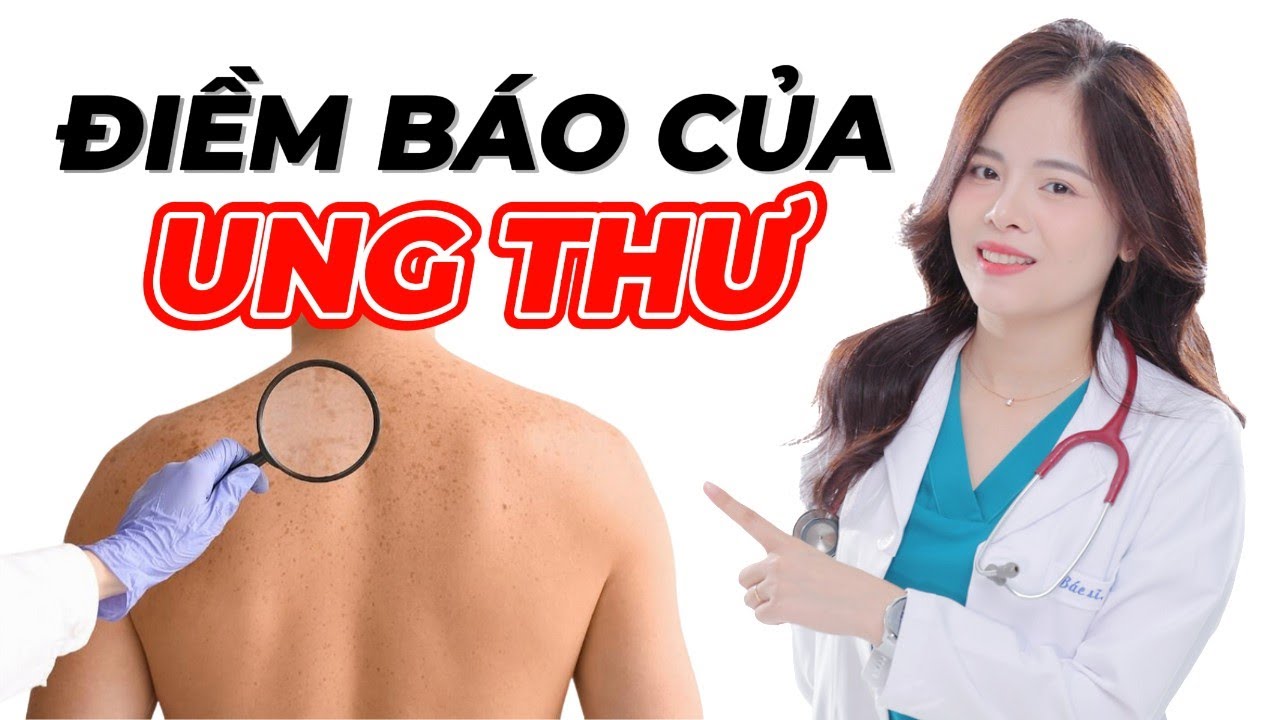 Các dấu hiệu cảnh báo UNG THƯ mà bạn cần ĐẶC BIỆT LƯU Ý | Dr Thùy Dung