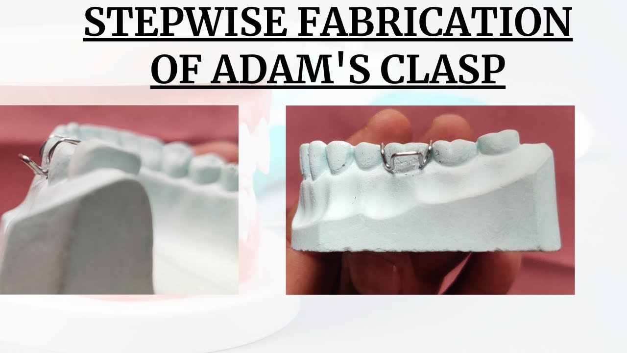 #adamsclasp | Adams clasp | Adam's Clasp Fabrication Step by step