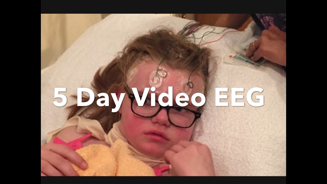 5 Day Video EEG