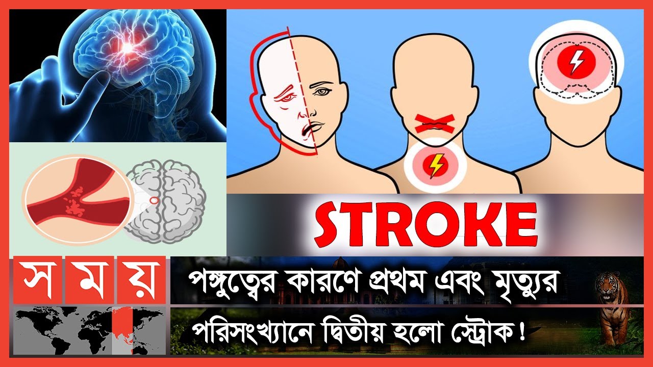 স্ট্রোক: সচেতনতার অভাবে যেতে পারে প্রাণ! | Stroke | World Stroke Day | Stroke Treatment | Somoy TV