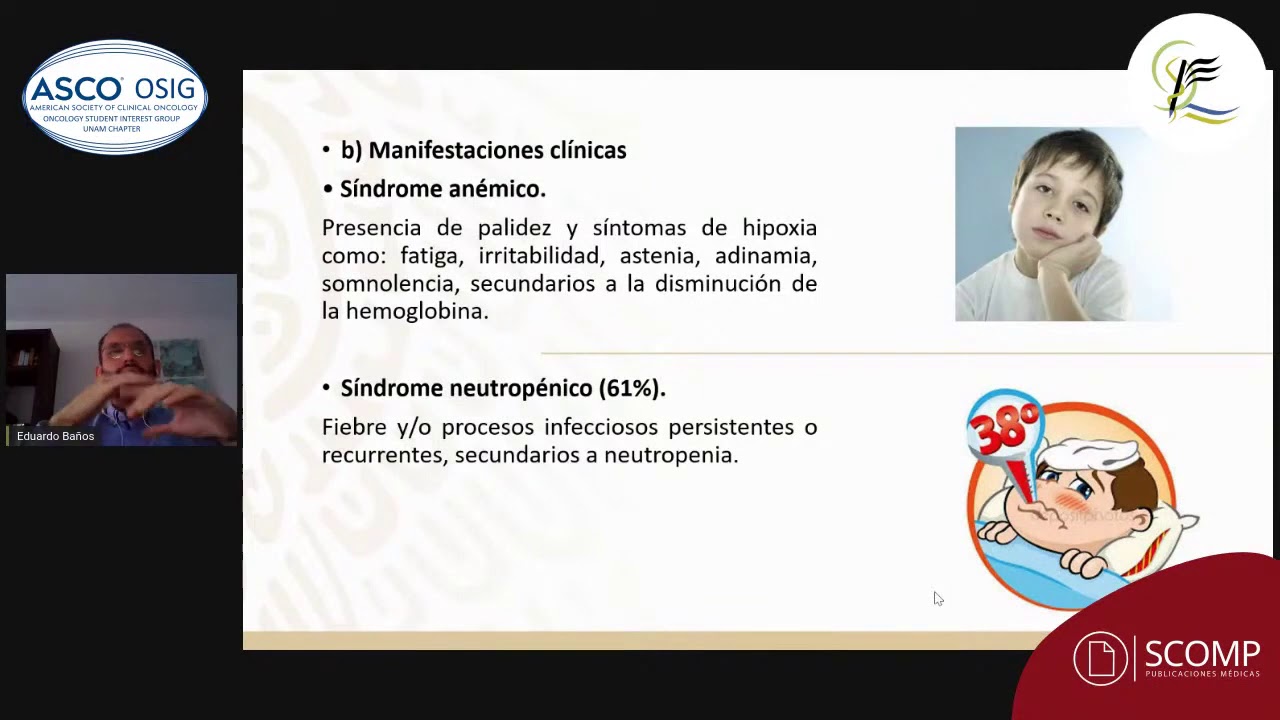 Leucemia linfoblástica aguda en niños