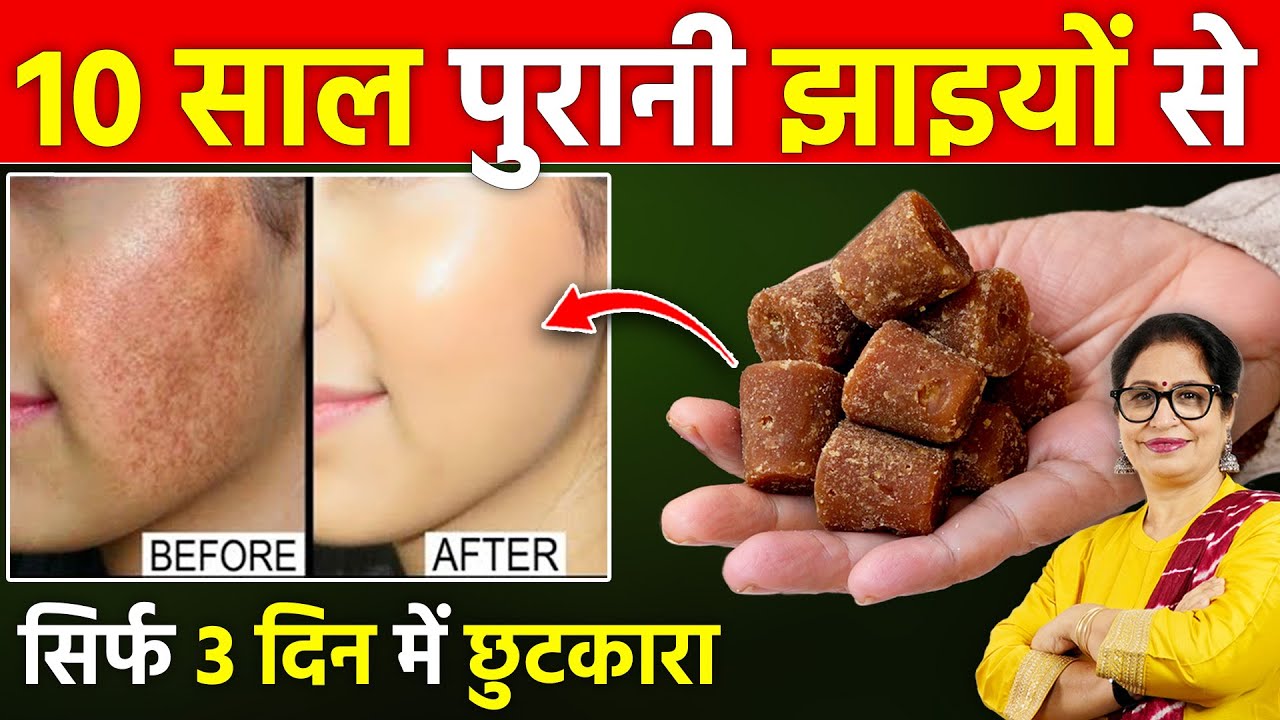सिर्फ 3 बार में कितनी भी पुरानी झाइयां, काले दाग-धब्बो से 100% छुटकारा | Jaggery Benefits For Face