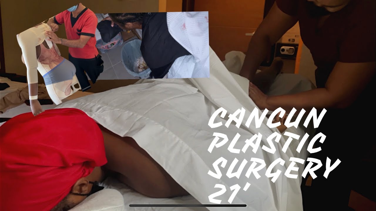 Liposuction in Cancun Mexico|Dr. Victor Samano|Post-Op Day 0-3|Lymphatic Massage|Vlog|Swearwordds