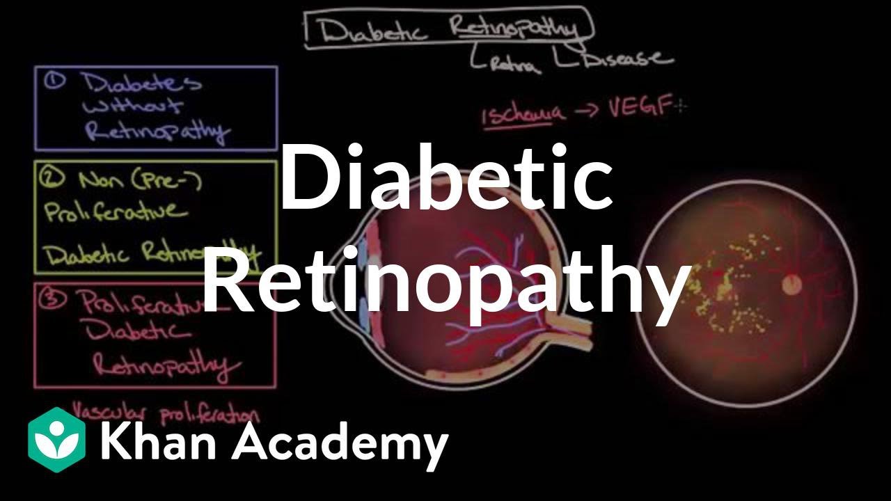 Diabetic retinopathy | Endocrine system diseases | NCLEX-RN | Khan Academy