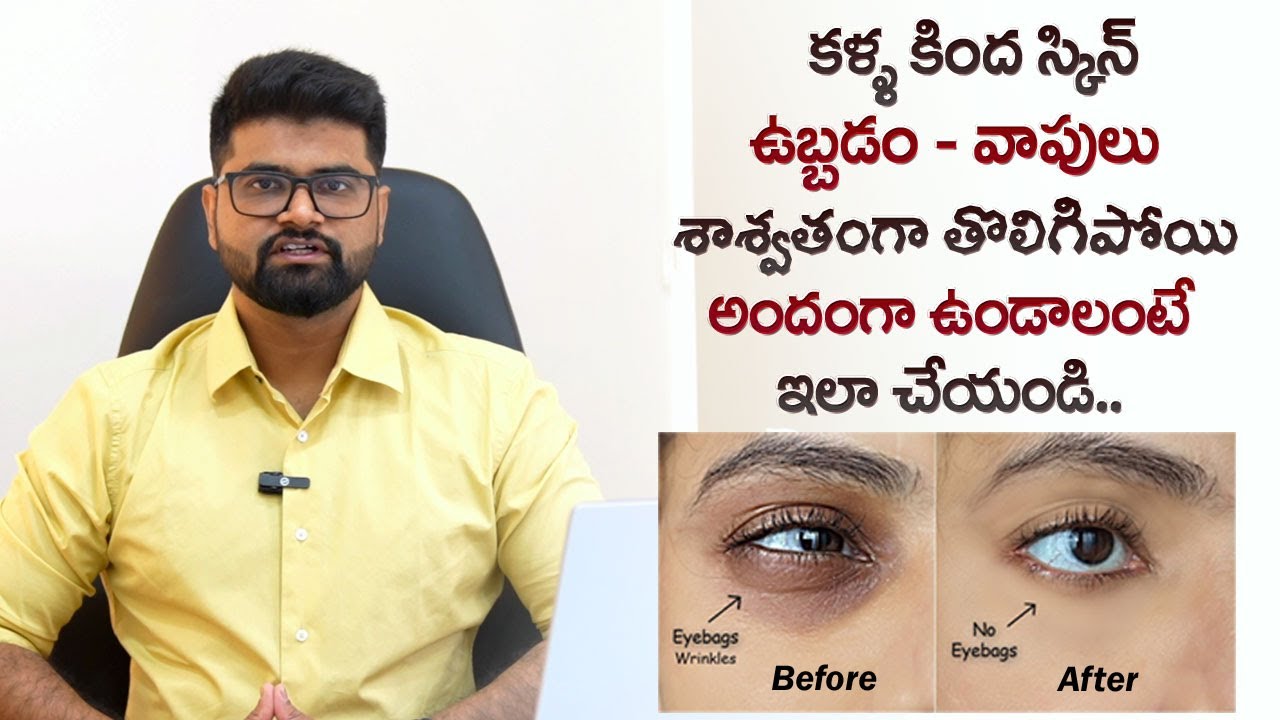 How to Reduce Eye Bags Naturally | Get Beautiful Eyes | Tips for Beautiful Eyes | Causes, Treatment