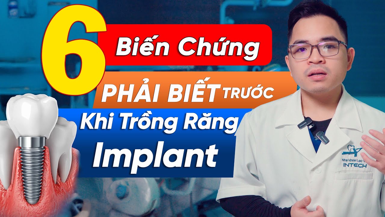 6 Biến Chứng PHẢI BIẾT TRƯỚC Khi Trồng Răng Implant – Đừng Chủ Quan Trước Khi Quyết Định