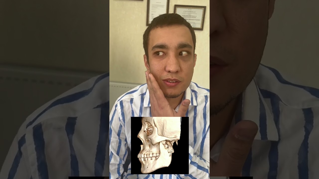 Notogri amalga oshirilgan operatsiya!