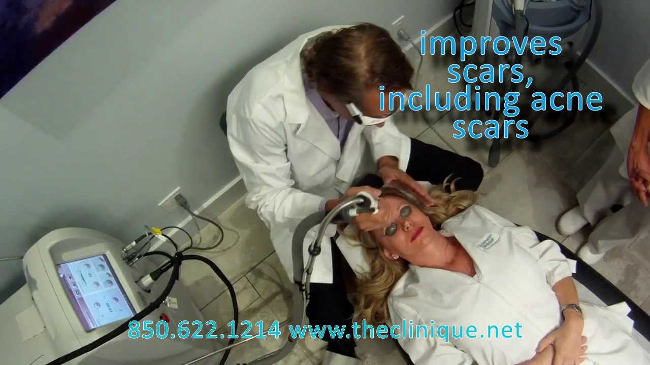 Fraxel Dual, VBeam, and Lightsheer Duet Lasers demonstrated by Steven F. Weiner, MD