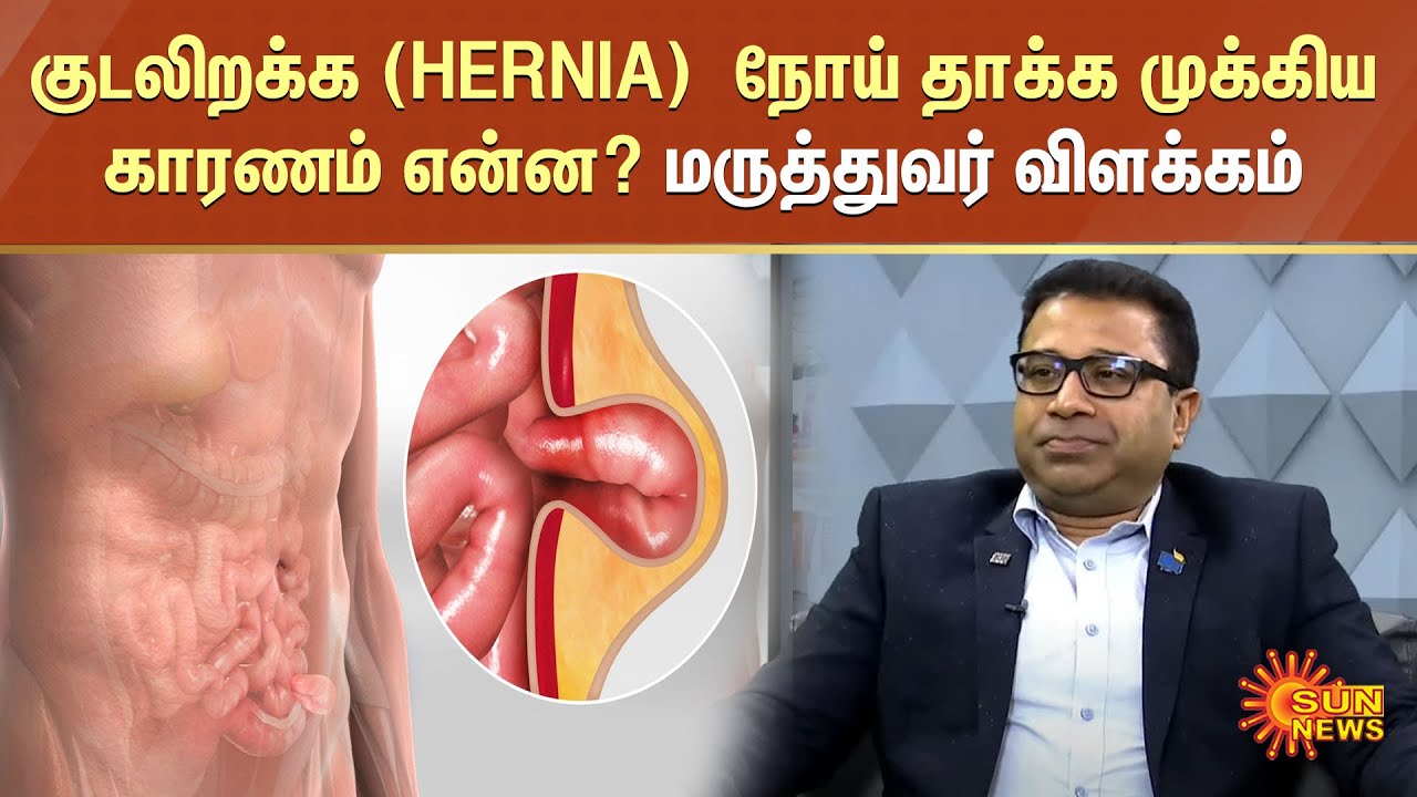 குடலிறக்க (HERNIA)  நோய் தாக்க முக்கிய காரணம் என்ன? மருத்துவர் பாலச்சந்திரன் விளக்கம்