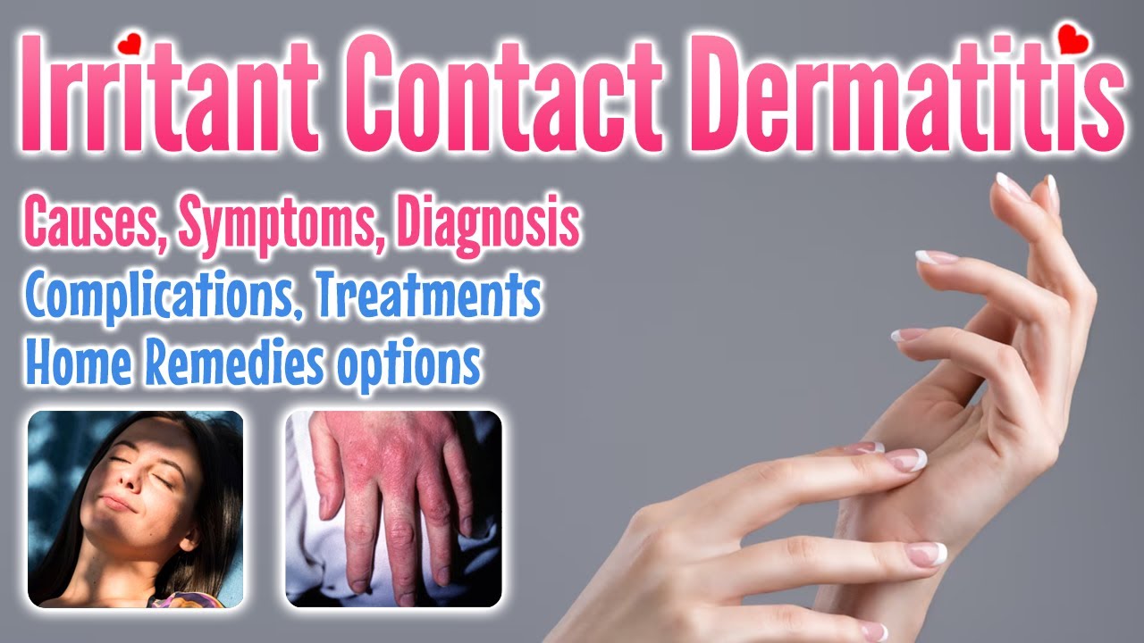 Irritant contact dermatitis overview, causes, symptoms, treatment options and home remedies