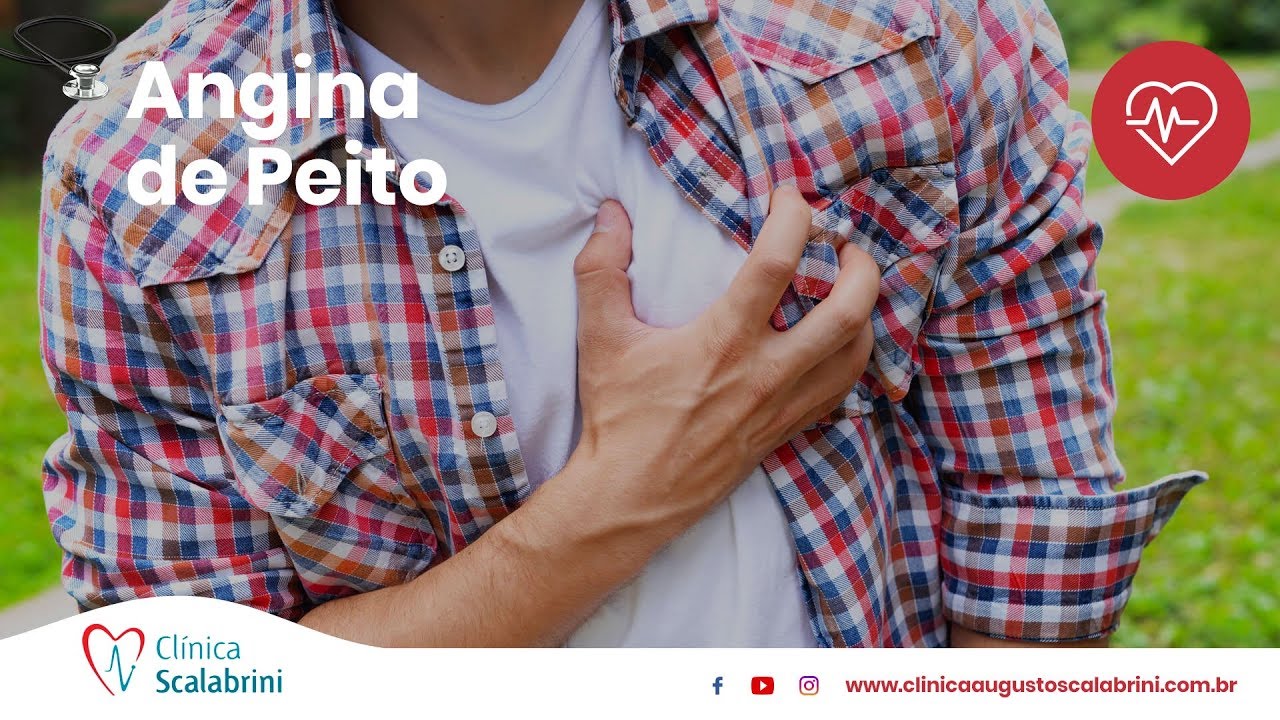 Angina de Peito | Por Prof Dr. Augusto Scalabrini