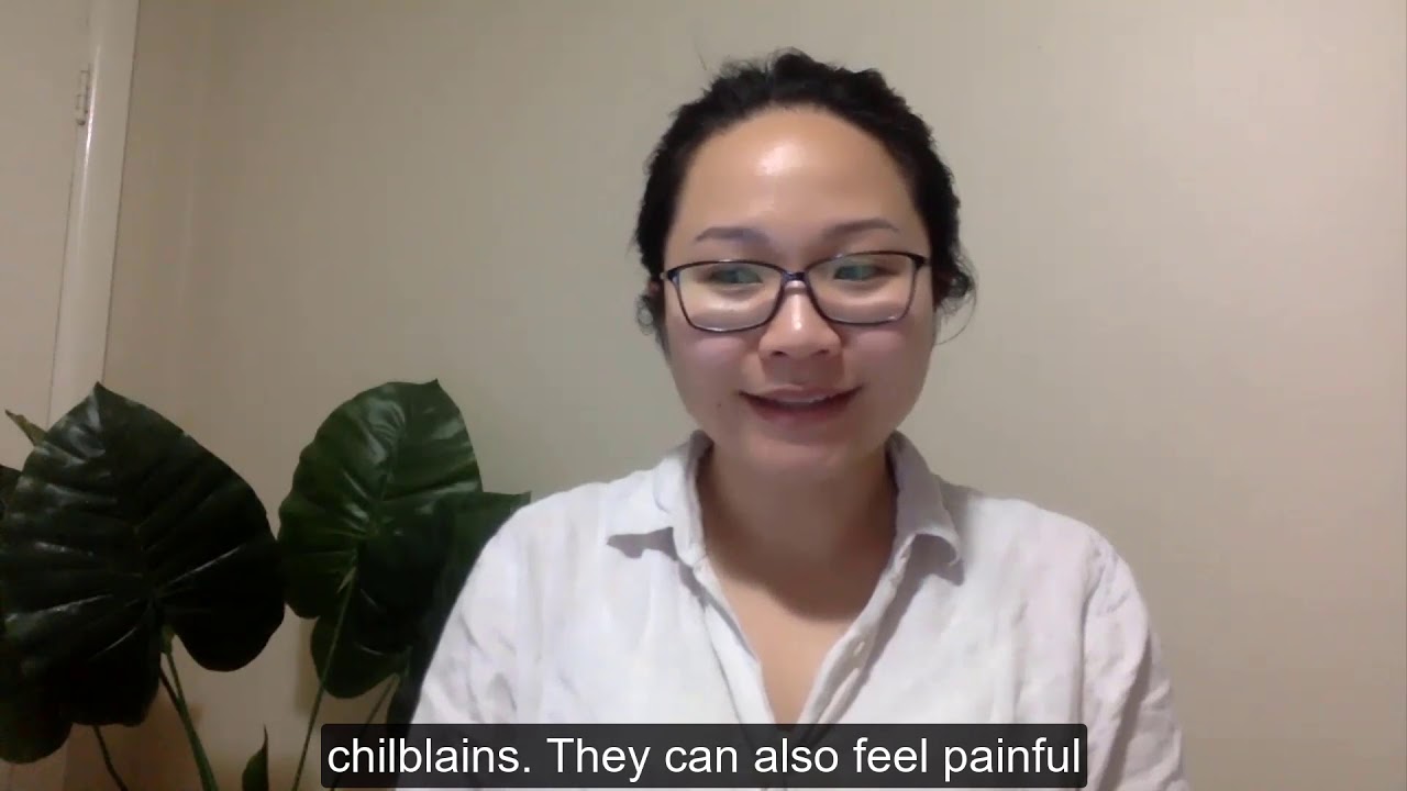 Chilblains - What they are and how to treat them