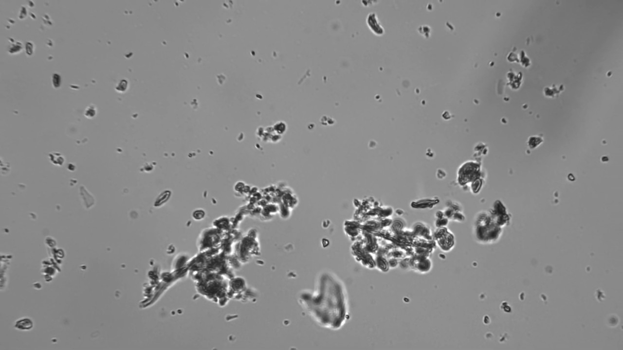 Using the Fungal to Bacterial Ratio with microBIOMETER&reg;
