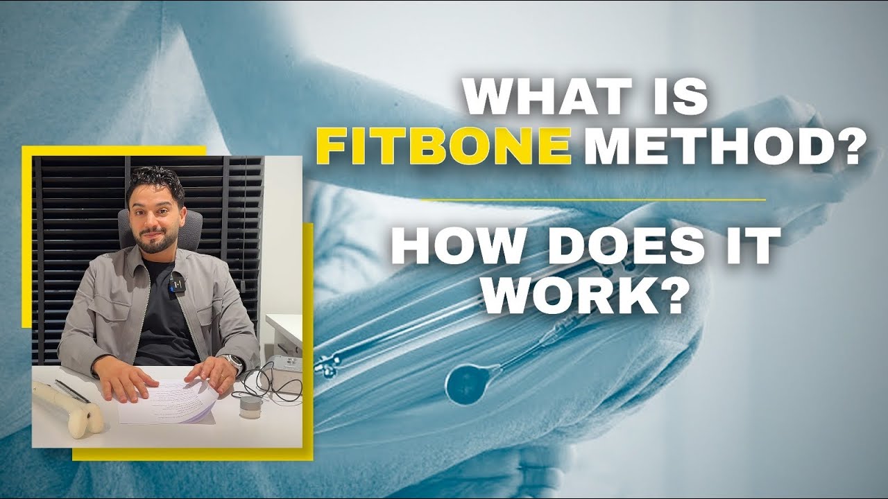 ЧТО ТАКОЕ МЕТОД FITBONE? КАК ОН РАБОТАЕТ?