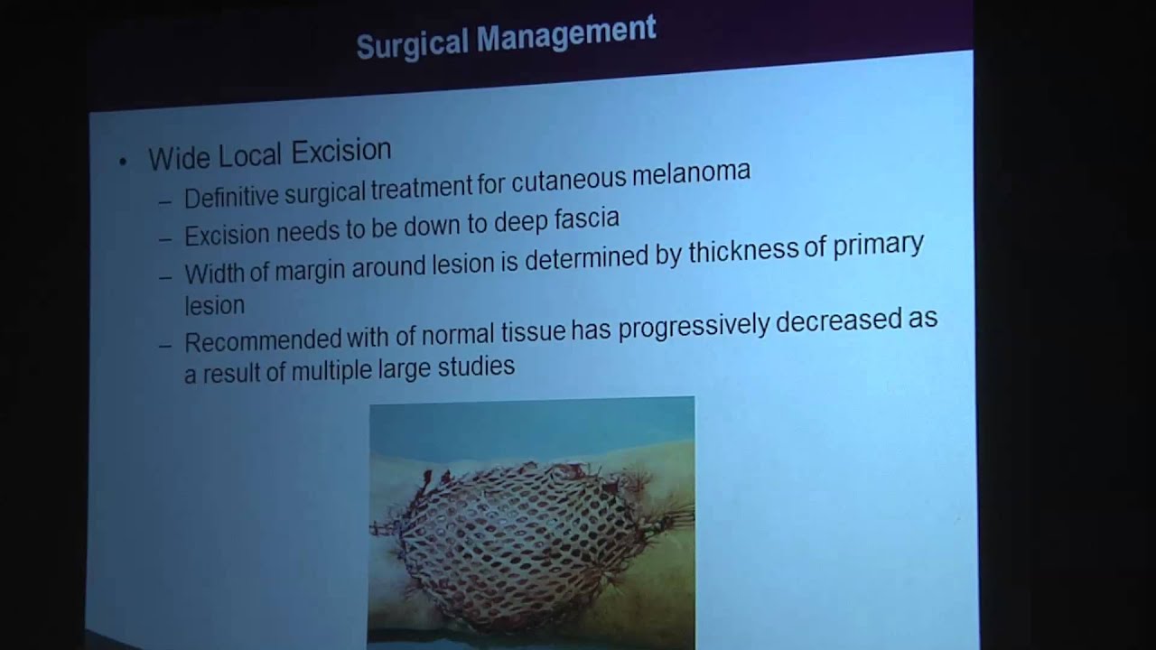 Melanoma-Surgical Considerations and Staging