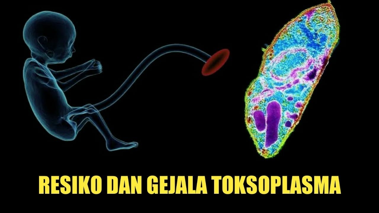 Mengenal Toksoplasma Pada Ibu Hamil, Dampak dan Gejalanya Jarang Diketahui