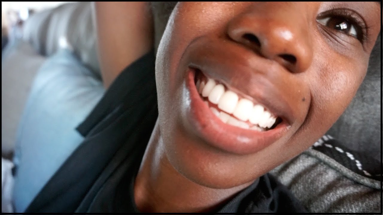 NEW TEETH | GOT MY PERMANENTS! Dental Bridge Journey!  - Part 3