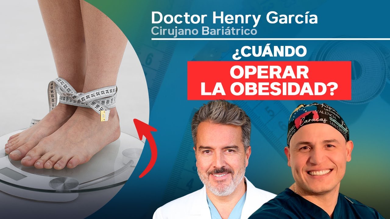¿Cuándo operar la obesidad?  #Bienestar #cirugíabariátrica