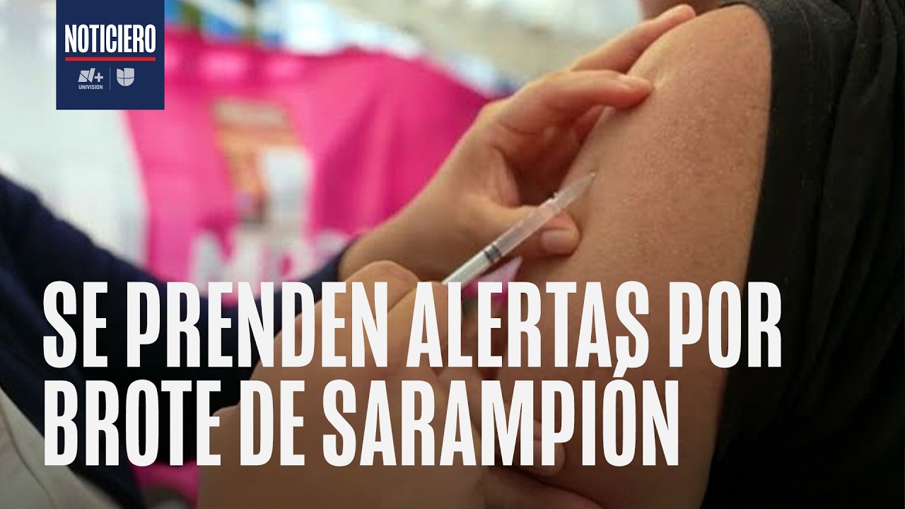 Brote de Sarampión: México suma 26 muertes, mientras EEUU cuadruplica sus casos